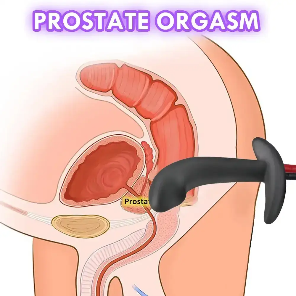 dispositivo electro estimulacion anal inalambrico